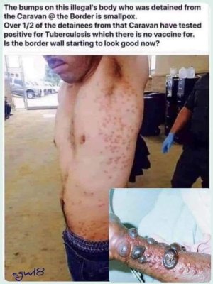 Strong Borders Stop Disease.jpg