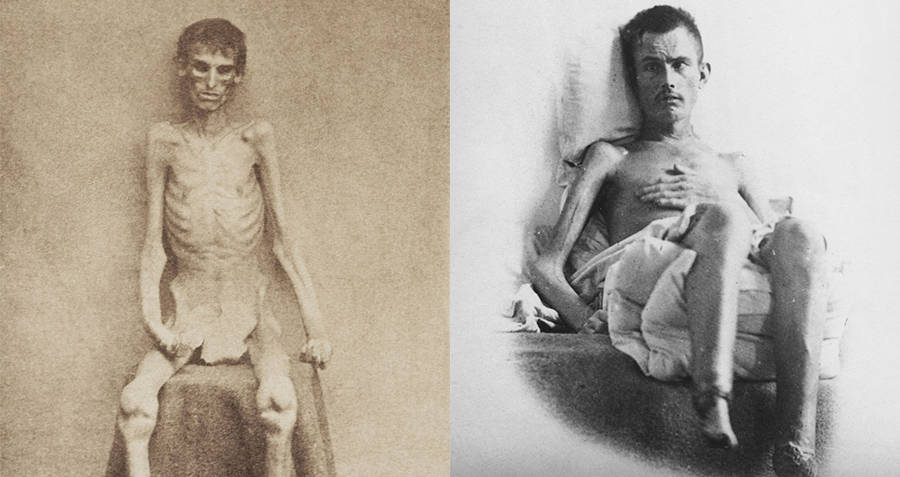 emaciated-prisoners.jpg