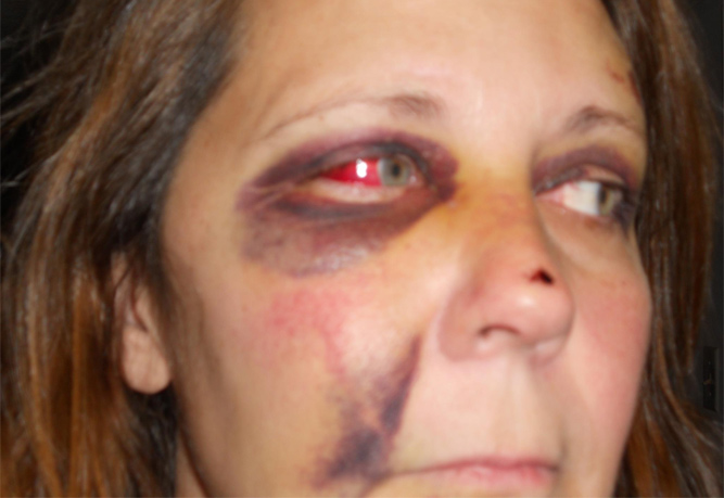 michelle-lane-beaten.jpg
