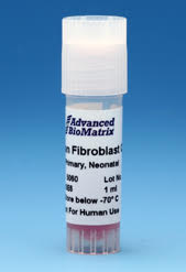 fibroblasts.jpg