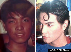 s-BEFORE-AFTER-SUPERMAN-PLASTIC-SURGERY-large300.jpg