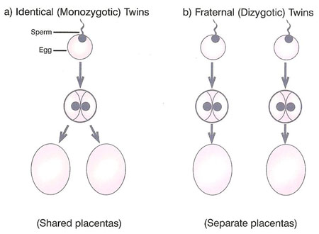 types_of_twins.jpg