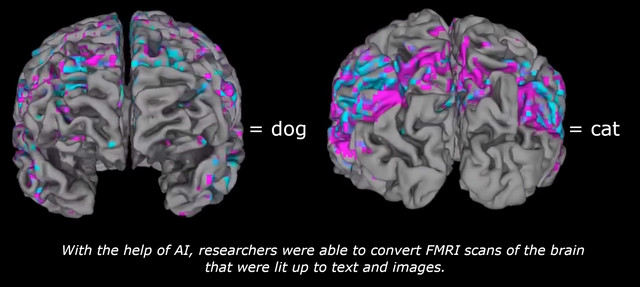 fmri.jpg