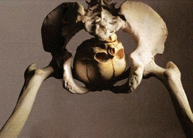 060921.skeleton.jpg