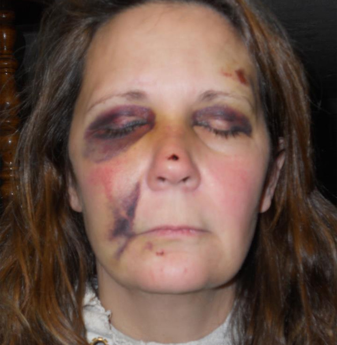michelle-lane-beaten-2.jpg