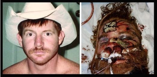 kellythomasbeforeafter_thumb_5.jpg
